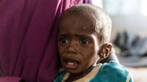 Identifikasi Dini Antara Kekurangan Gizi dan Gizi Buruk