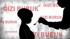 Mengatasi Ancaman Gizi Buruk pada Anak: Peran Bersama